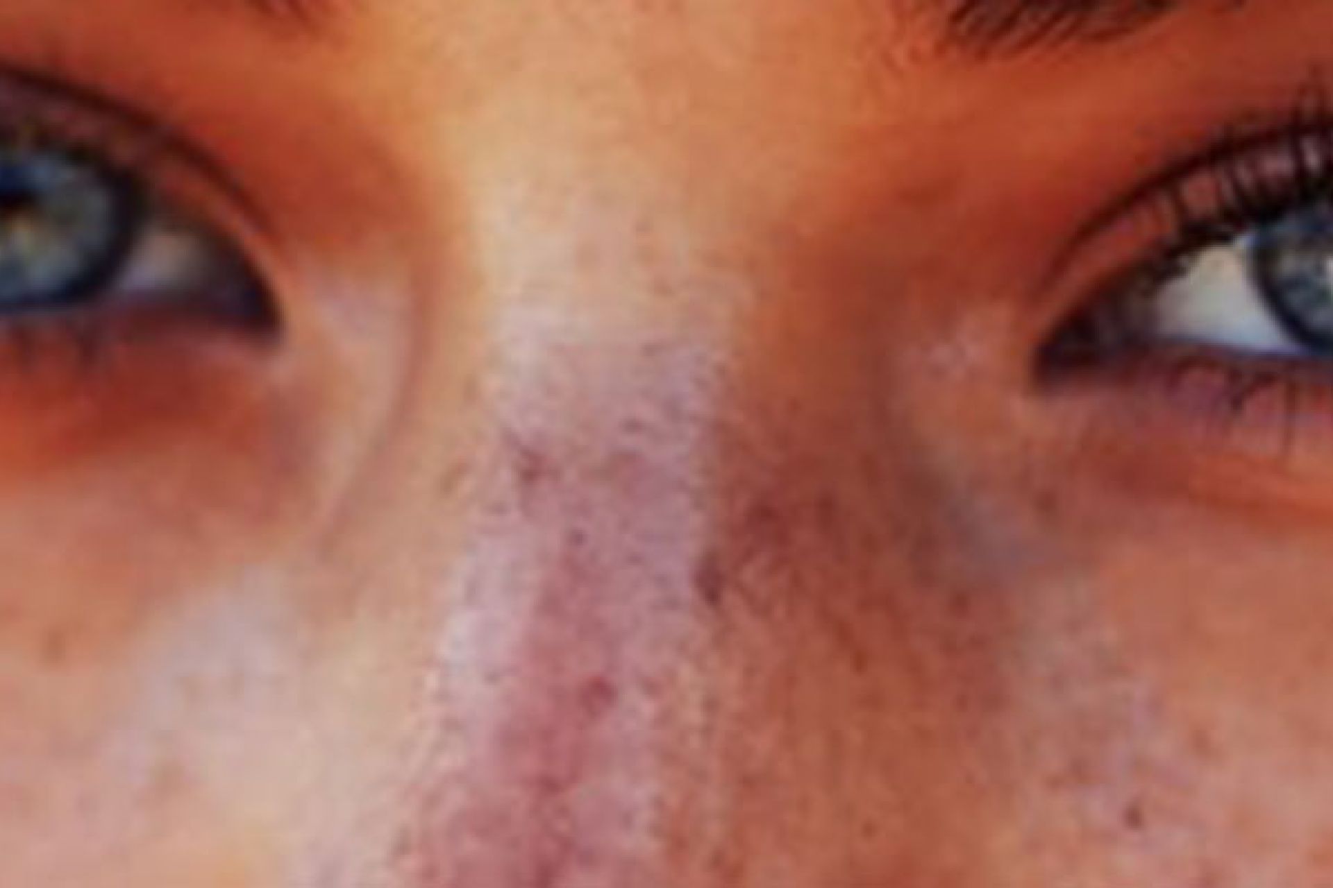 Protección solar, piel perfecta